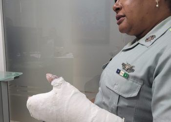 Agentes DIGESETT aparecen con yesos y 'chichones'