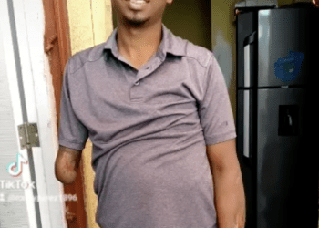 “Ni empresas, ni Gobierno lo emplean”: denuncia joven con discapacidad