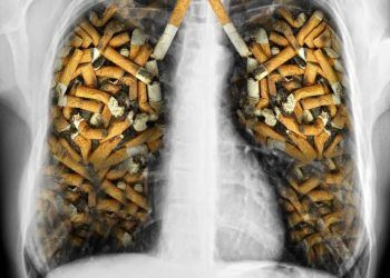 Hoy 31 de mayo Día Mundial Sin Tabaco