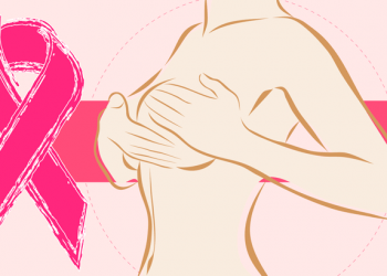 Mortalidad por cáncer de mama disminuye un 1 % cada año