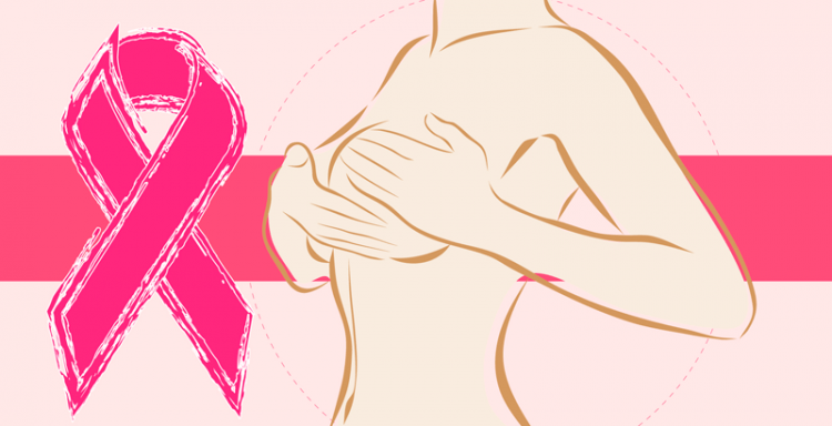 Mortalidad por cáncer de mama disminuye un 1 % cada año