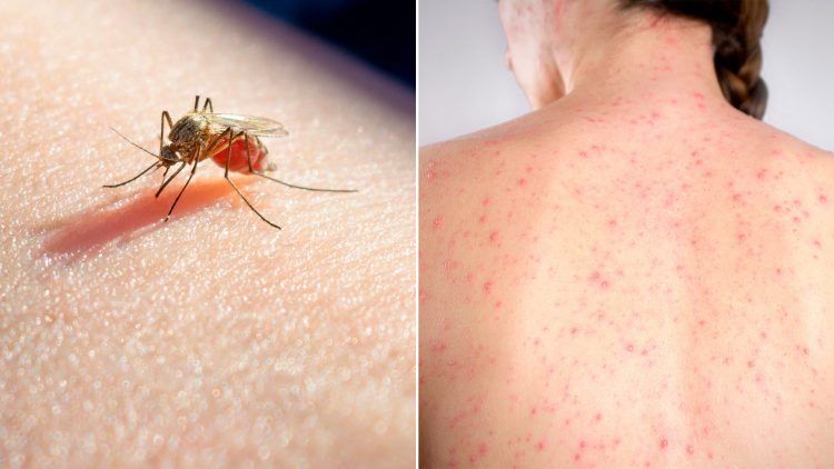 Dengue deja ocho muertos y 1,623 infectados