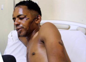 Un hombre salvo su vida milagrosamente de nacionales haitianos