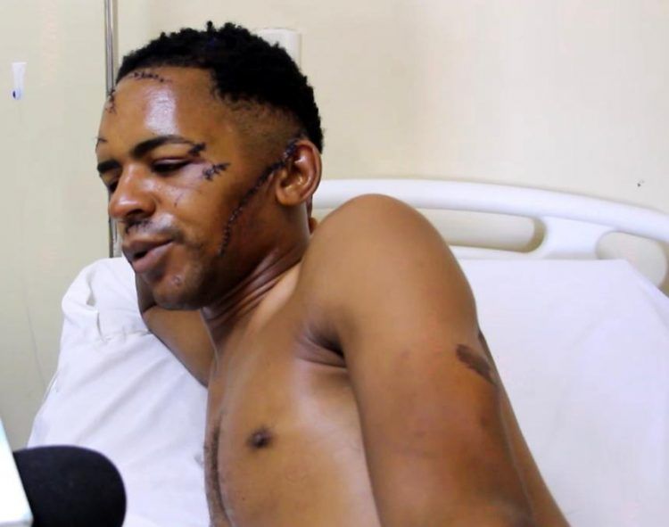 Un hombre salvo su vida milagrosamente de nacionales haitianos