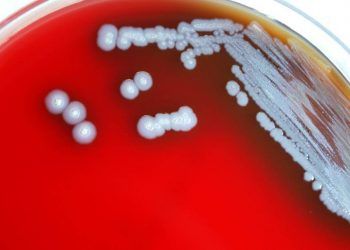 Alerta sanitaria sobre bacteria de enfermedad rara en Misisipi 