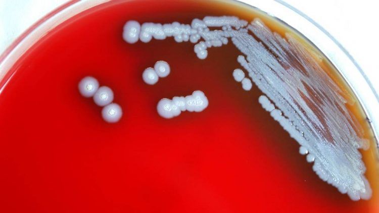 Alerta sanitaria sobre bacteria de enfermedad rara en Misisipi 