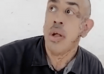 Discriminado por su apariencia pide ayuda a la primera dama para conseguir empleo