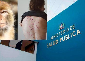 Salud Pública confirmará hoy caso sospechoso viruela del mono 