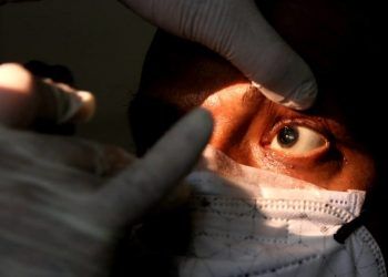 Se registraron 41 casos de hongo negro en Honduras 