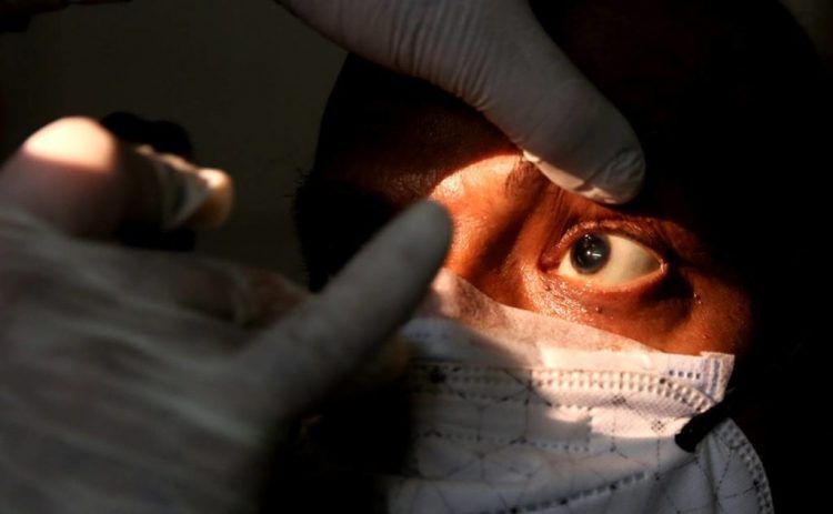 Se registraron 41 casos de hongo negro en Honduras 