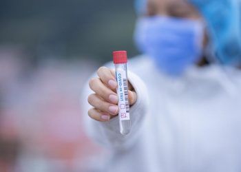 393 nuevos casos positivos de Covid-19