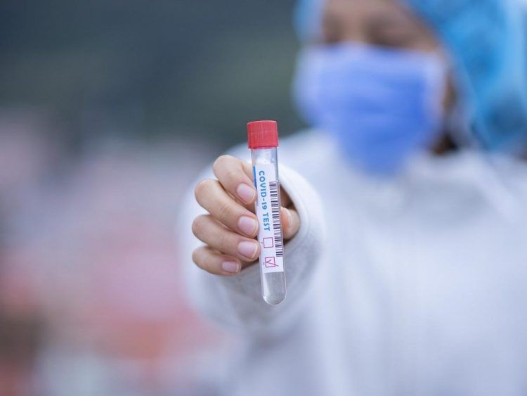 393 nuevos casos positivos de Covid-19