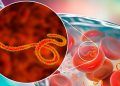 Fiebre hemorrágica en la lista de enfermedades infecciosas con mayor riesgo