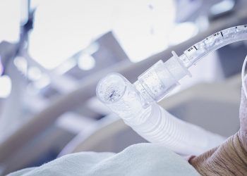 Salud Pública notifica muerte por COVID-19 tras varios meses