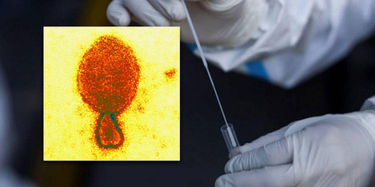 ¡NUEVO VIRUS! Tiene origen animal y ya existen 35 casos en China