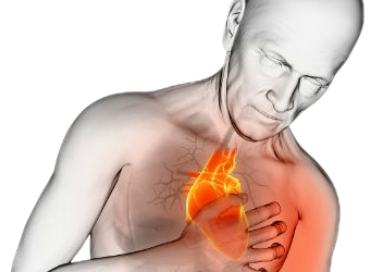 5 alimentos que pueden incrementar el riesgo de infarto al corazón