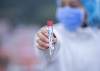 Salud Pública reporta 952 nuevos casos de Covid-19