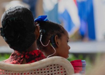 Anuncian segunda jornada de implantes cocleares en niños con déficit auditivo