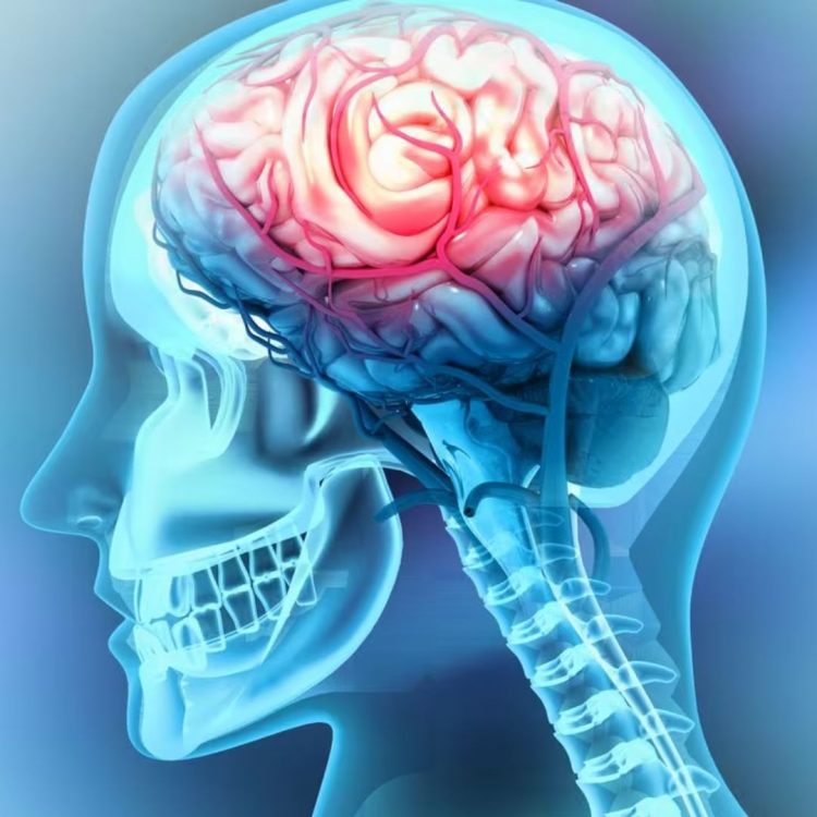 científicos demuestran exposición prolongada a contaminación vehicular puede traer Alzheimer