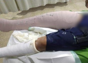 Estudiante resulta herido tras caerle encima muro en una escuela de Santo Domingo