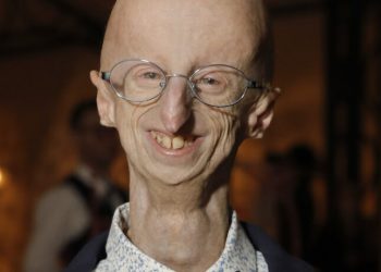 Fallece Sammy Basso, el científico que visibilizó el síndrome que le envejecía prematuramente