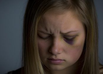 Mujer causa daño a su hija y luego se suicida en SFM