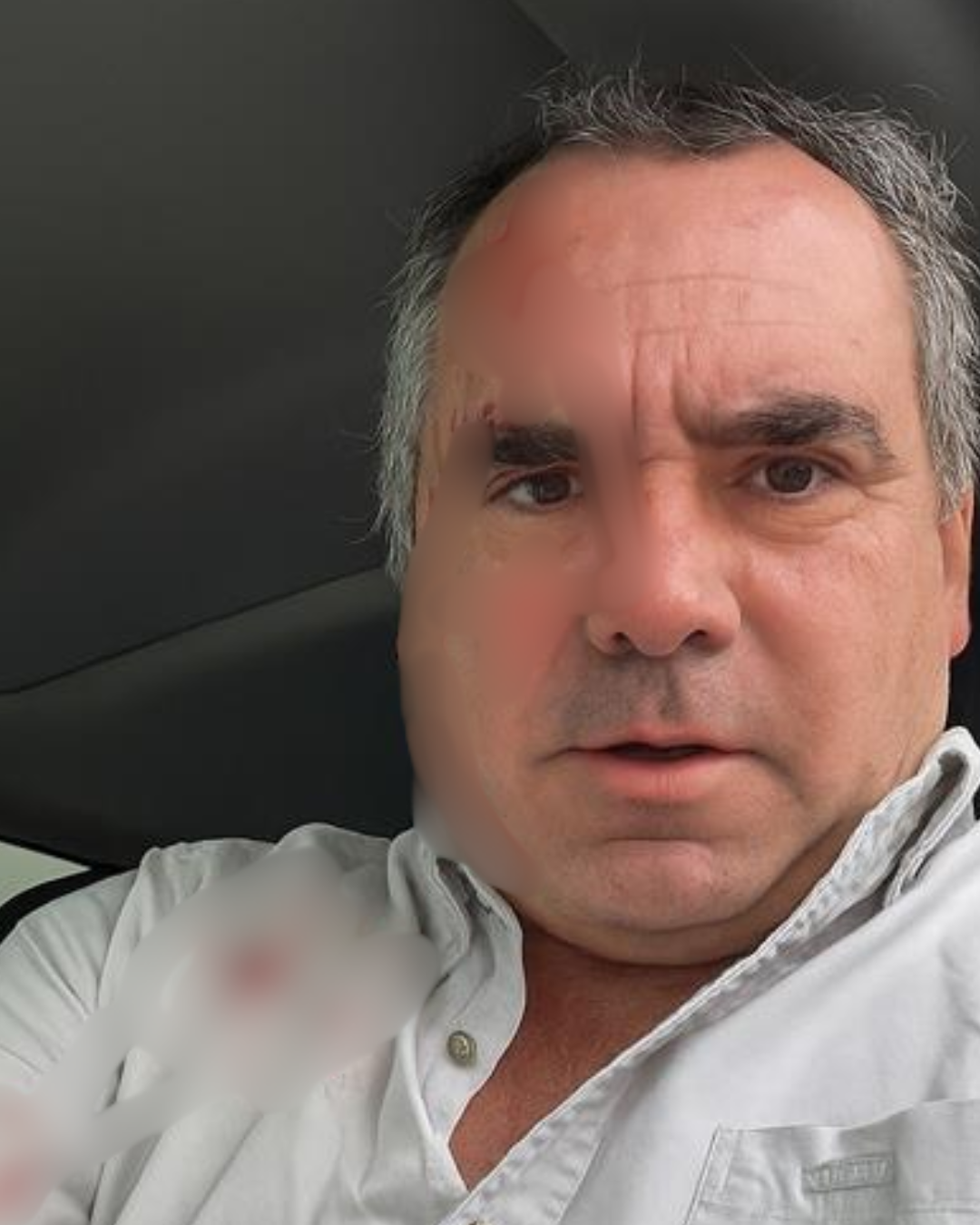 ¡Sobrevivió!: Candidato presidencial enfrenta tiroteo y vive para contarlo en Perú